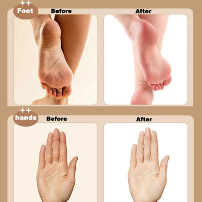 Lixa 3 em 1 elétrico removedor de calos